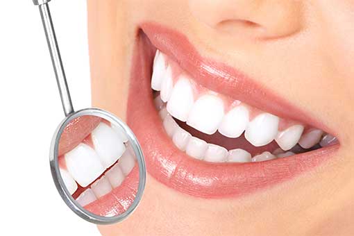how often to whiten teeth at home